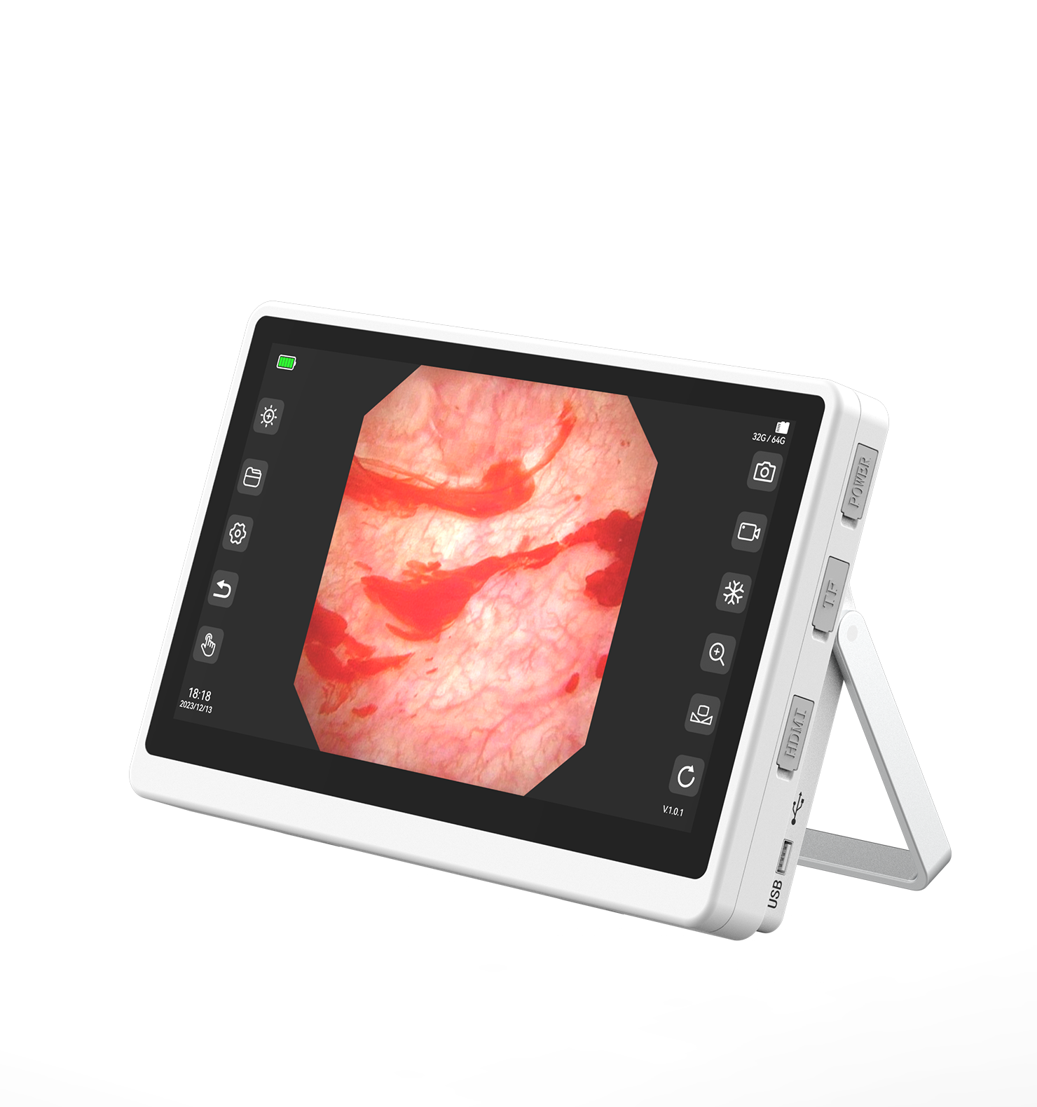 便携式电子内窥镜成像设备